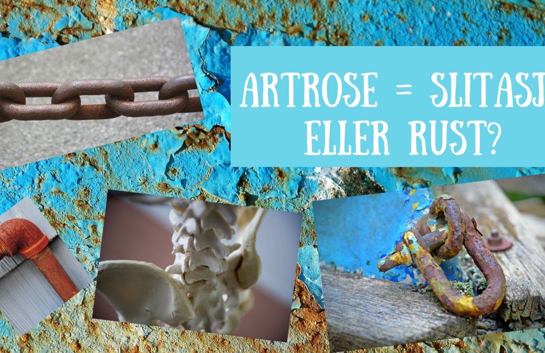 Artrose, er det pga slitasje eller rust?